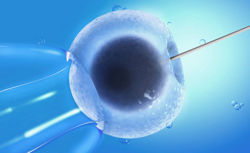 生孩子直拍宫口