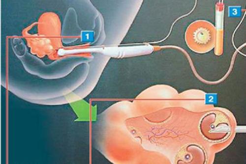男性生育能力差