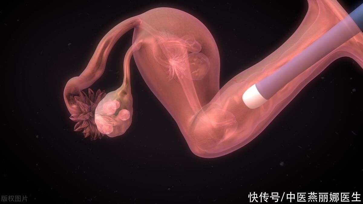 着床出血