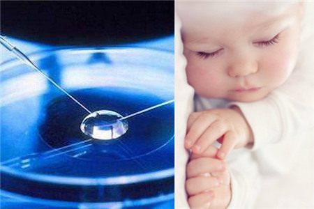 大连女人做试管疼不疼